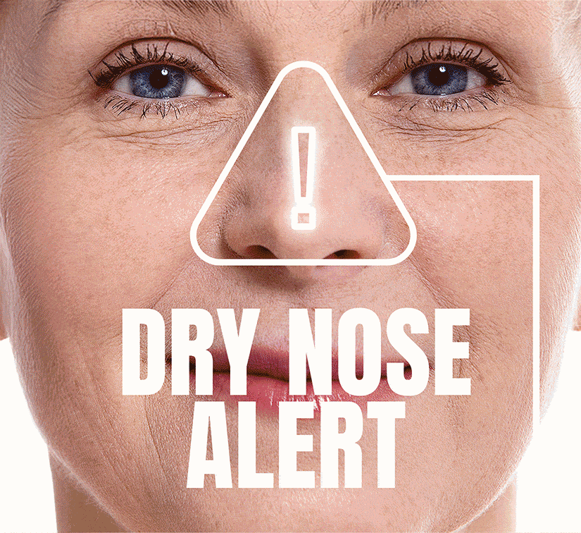 dry nose alert