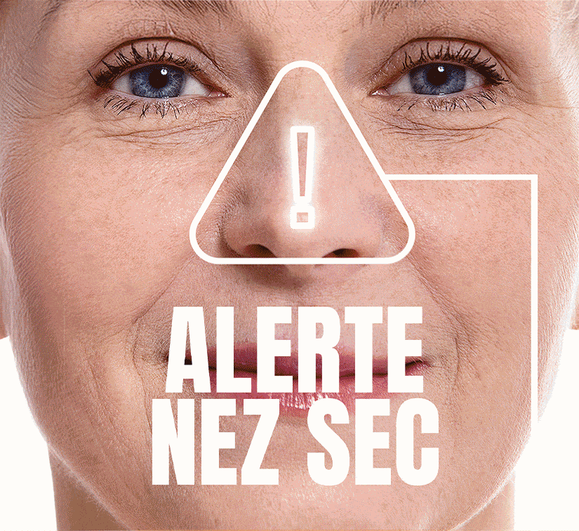dry nose alert