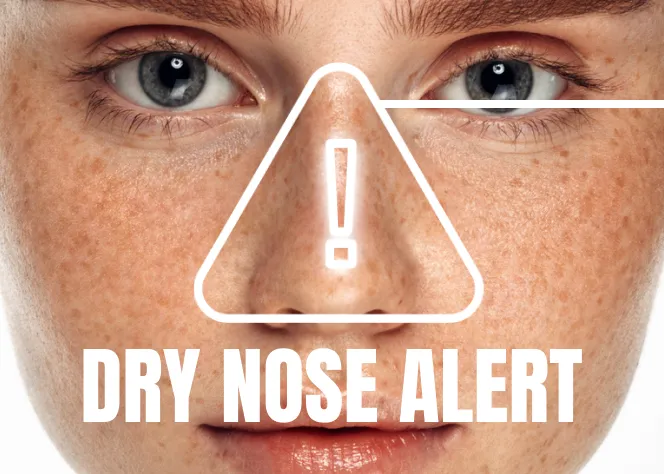 dry nose alert