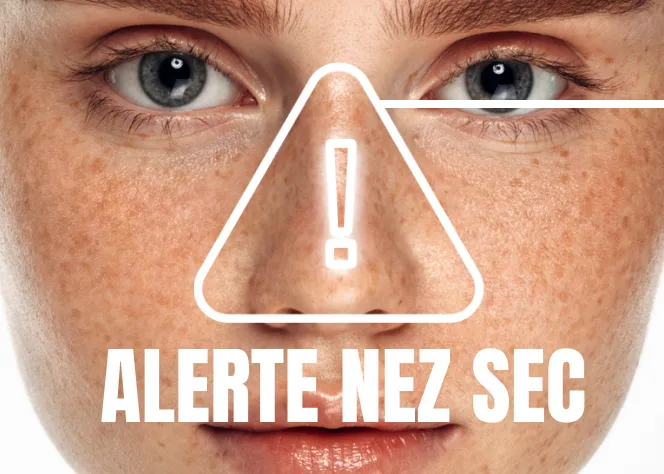 dry nose alert